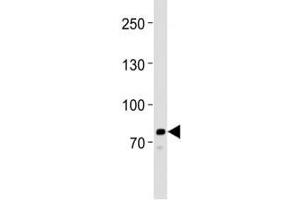 Western Blotting (WB) image for anti-Proprotein Convertase Subtilisin/kexin Type 9 (PCSK9) (AA 479-508) antibody (ABIN3032342)