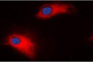 Immunofluorescent analysis of MMP8 staining in SW620 cells. (MMP8 antibody  (C-Term))