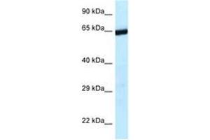 Image no. 1 for anti-Excision Repair Cross-Complementing Rodent Repair Deficiency, Complementation Group 6-Like 2 (ERCC6L2) (AA 1120-1169) antibody (ABIN6747427) (ERCC6L2 antibody  (AA 1120-1169))