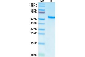 ROR2 Protein (AA 34-403) (His-Avi Tag)