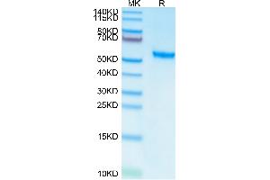 Human ROR2 on Tris-Bis PAGE under reduced conditions. (ROR2 Protein (AA 34-403) (His-Avi Tag))