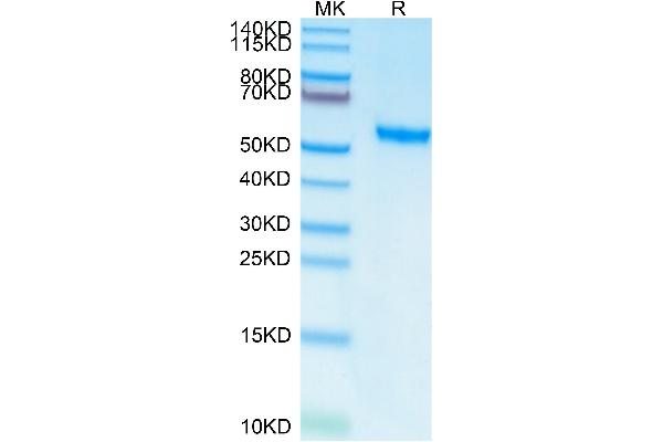 ROR2 Protein (AA 34-403) (His-Avi Tag)