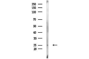 anti-Small Proline-Rich Protein 3 (SPRR3) (Internal Region) antibody