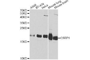 Western blot analysis of extracts of various cell lines, using CSRP1 Antibody. (CSRP1 antibody  (AA 1-193))