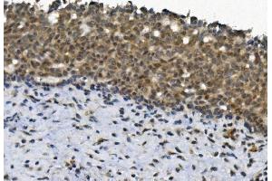 IHC analysis of EYA4 using anti-EYA4 antibody (ABIN7601063). (EYA4 antibody  (AA 28-205))
