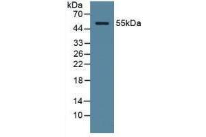 Detection of ODC in Human Serum using Polyclonal Antibody to Ornithine Decarboxylase (ODC) (ODC1 antibody  (AA 15-259))