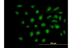 Immunofluorescence of monoclonal antibody to SUPT5H on HeLa cell. (SUPT5H antibody  (AA 981-1087))