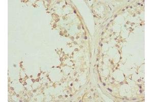 Immunohistochemistry of paraffin-embedded human testis tissue using ABIN7146876 at dilution of 1:100 (Casein Kinase 1 gamma 2 antibody  (Isoform gamma 2))