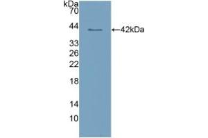 Western blot analysis of recombinant Human CLEC4L. (DC-SIGN/CD209 antibody  (AA 70-404))