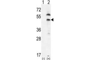 Western Blotting (WB) image for anti-Platelet-Derived Growth Factor Receptor-Like (PDGFRL) antibody (ABIN3003406)