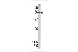 Western blot analysis of anti-Phospho-STAT1 Pab (ABIN389662 and ABIN2839643) in mouse brain tissue lysate (35 μg/lane). (STAT1 antibody  (pSer727))