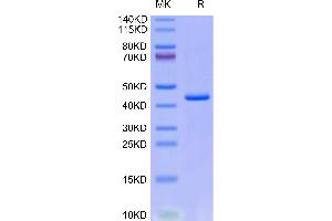 PF4V1 Protein (AA 31-104) (Fc Tag)
