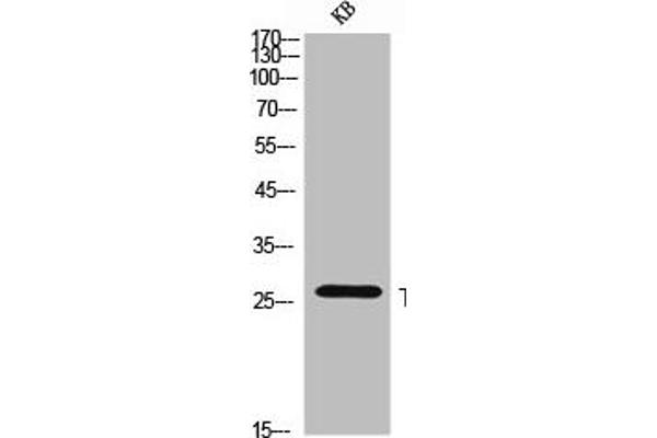 TNFSF8 antibody  (Internal Region)