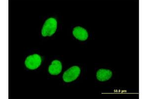 Immunofluorescence of purified MaxPab antibody to RPRD1A on HeLa cell. (RPRD1A antibody  (AA 1-289))