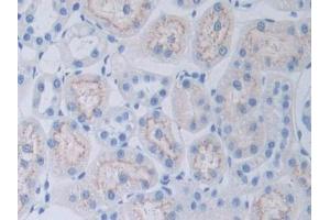 DAB staining on IHC-P; Samples: Rat Kidney Tissue (Adipsin antibody  (AA 1-263))
