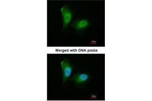 ICC/IF Image Immunofluorescence analysis of paraformaldehyde-fixed HeLa, using 20S Proteasome alpha2, antibody at 1:200 dilution. (PSMA2 antibody  (Center))