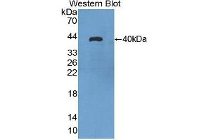 Western blot analysis of the recombinant protein. (Aquaporin 8 antibody  (AA 129-228))
