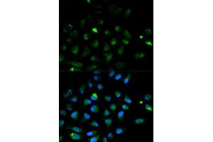 Immunofluorescence analysis of HeLa cell using PRF1 antibody. (Perforin 1 antibody  (AA 280-555))