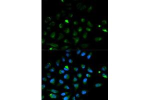 Immunofluorescence analysis of HeLa cell using PRF1 antibody. (Perforin 1 antibody  (AA 280-555))