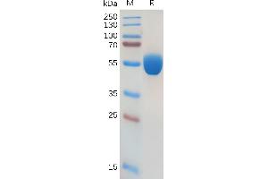 Human GM-CSF Protein, hFc Tag on SDS-PAGE under reducing condition.