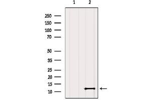 Western blot analysis of extracts from Mouse brain, using SH3BGRL2 Antibody. (SH3BGRL2 antibody  (Internal Region))