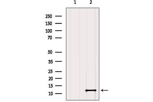 SH3BGRL2 antibody  (Internal Region)