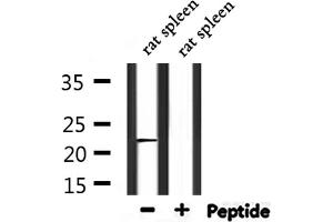 Western blot analysis of extracts from rat spleen, using C56D2 Antibody. (CYB561D2 antibody)