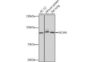 Western blot analysis of extracts of various cell lines, using MCM4 Rabbit mAb (ABIN7268545) at 1:1000 dilution. (MCM4 antibody)