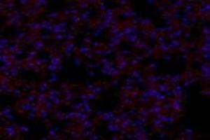 Immunofluorescent analysis of paraformaldehyde-fixed mouse lung using,GNE (ABIN7074056) at dilution of 1: 600 (GNE antibody)