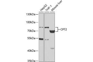 Western blot analysis of extracts of various cell lines, using CPT2 antibody (ABIN3023423, ABIN3023424, ABIN3023425 and ABIN6219865) at 1:400 dilution. (CPT2 antibody)