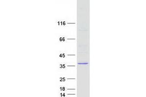 Validation with Western Blot (TATDN3 Protein (Transcript Variant 2) (Myc-DYKDDDDK Tag))