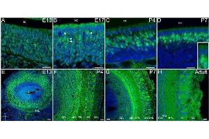 Dvl-2 is expressed in OSN, in all layers through the olfactory bulb and is associated with synapses inside the glomeruli. (DVL2 antibody  (Internal Region))