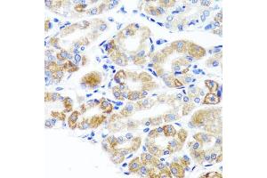 Immunohistochemistry of paraffin-embedded human stomach using DLG1 antibody.