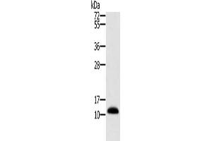 Gel: 10 % SDS-PAGE, Lysate: 40 μg, Lane: Human prostate tissue, Primary antibody: ABIN7130278(MSMB Antibody) at dilution 1/250, Secondary antibody: Goat anti rabbit IgG at 1/8000 dilution, Exposure time: 1 second (MSMB antibody)