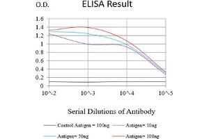 Black line: Control Antigen (100 ng),Purple line: Antigen (10 ng), Blue line: Antigen (50 ng), Red line:Antigen (100 ng) (TACI antibody)