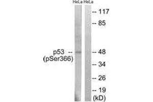 Western blot analysis of extracts from HeLa cells treated with Adriamycin 0. (p53 antibody  (pSer366))