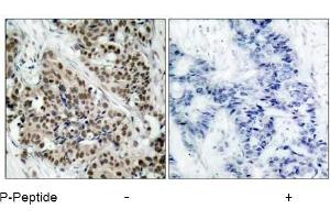 Image no. 3 for anti-Forkhead Box O1 (FOXO1) (pSer256) antibody (ABIN196813) (FOXO1 antibody  (pSer256))