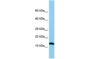 WB Suggested Anti-Spa17 Antibody Titration: 1. (SPA17 antibody  (Middle Region))
