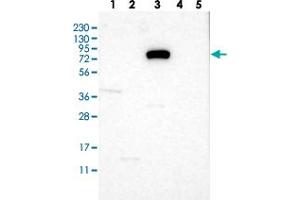 Western blot analysis of Lane 1: RT-4, Lane 2: U-251 MG, Lane 3: Human Plasma, Lane 4: Liver, Lane 5: Tonsil with SLC6A9 polyclonal antibody . (GLYT1 antibody)