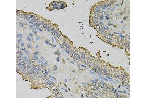 Immunohistochemistry of paraffin-embedded Human prostate using AZGP1 Polyclonal Antibody at dilution of 1:100 (40x lens). (AZGP1 antibody)