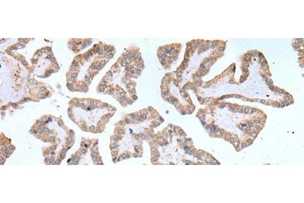 ABCD1 antibody