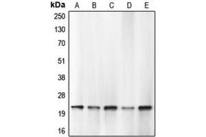 Western blot analysis of Caspase 1 expression in HEK293T PMA-treated (A), THP1 (B), HL60 (C), mouse lung (D), rat lung (E) whole cell lysates.