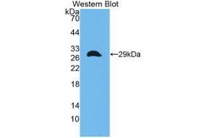 Western blot analysis of the recombinant protein. (CITED1 antibody  (C-Term))