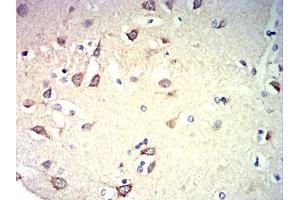 Immunohistochemical analysis of paraffin-embedded brain tissues using CD57 mouse mAb with DAB staining. (CD57 antibody  (AA 28-334))