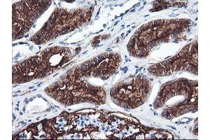 Immunohistochemical staining of paraffin-embedded Human Kidney tissue using anti-ENPEP mouse monoclonal antibody. (ENPEP antibody)