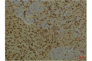 Immunohistochemical analysis of paraffin-embedded Mouse BrainTissue using HIF-1 β/ARNT Mouse mAb diluted at 1:200. (ARNT antibody)