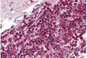 Human Spleen (formalin-fixed, paraffin-embedded) stained with TLR8 antibody ABIN334256 at 5 ug/ml followed by biotinylated anti-mouse IgG secondary antibody ABIN481714, alkaline phosphatase-streptavidin and chromogen. (TLR8 antibody  (AA 750-850))