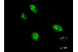 Immunofluorescence of purified MaxPab antibody to C1orf25 on HeLa cell. (TRMT1L antibody  (AA 1-733))