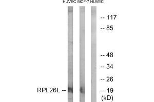 Western blot analysis of extracts from HUVEC cells and MCF-7 cells, using RPL26L antibody. (RPL26L antibody  (C-Term))
