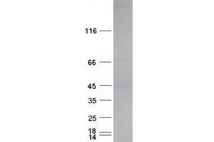 Western Blotting (WB) image for Eukaryotic Translation Initiation Factor 4 Gamma, 1 (EIF4G1) (Transcript Variant 2) protein (Myc-DYKDDDDK Tag) (ABIN2720103)